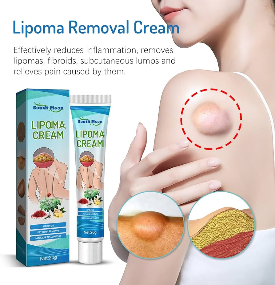 Lipoma Removal Cream (20g)